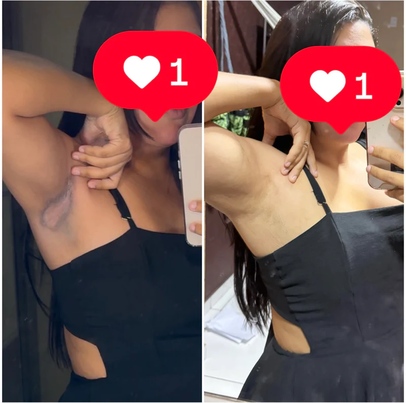 Antes do tratamento